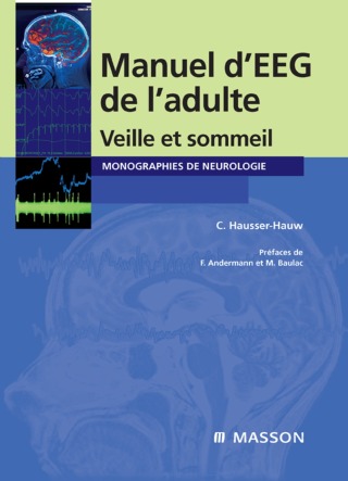 Manuel d'EEG de l'adulte