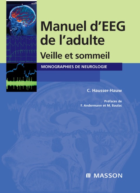 Cover image for book Manuel d'EEG de l'adulte