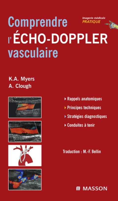 Comprendre l'Echo-Doppler vasculaire 