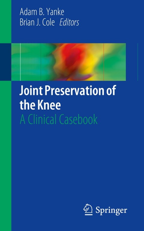 Cover image for book Joint Preservation of the Knee
