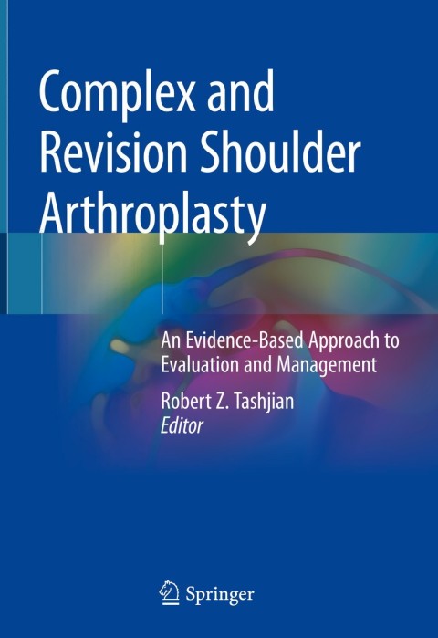 Cover image for book Complex and Revision Shoulder Arthroplasty