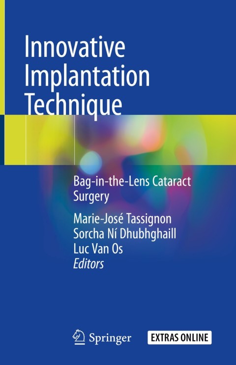Cover image for book Innovative Implantation Technique