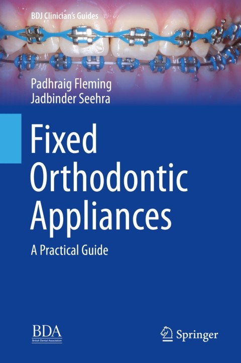 Cover image for book Fixed Orthodontic Appliances