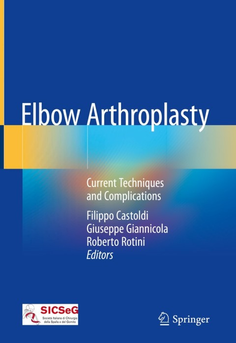 Cover image for book Elbow Arthroplasty