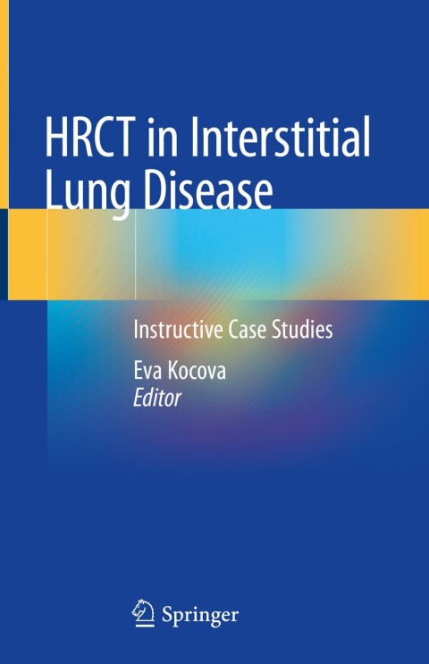 Cover image for book HRCT in Interstitial Lung Disease