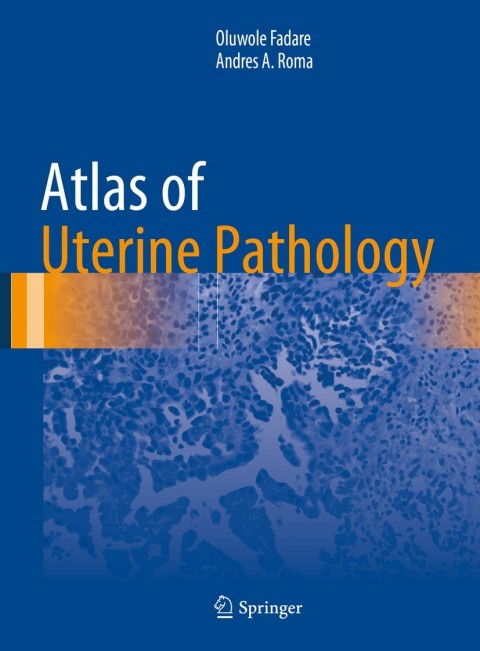 Cover image for book Atlas of Uterine Pathology