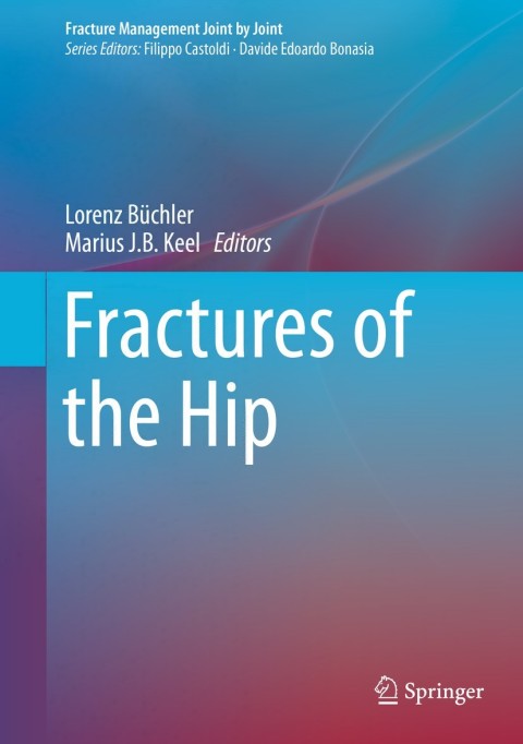 Cover image for book Fractures of the Hip