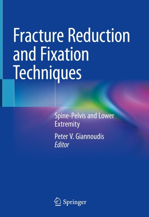 Cover image for book Fracture Reduction and Fixation Techniques