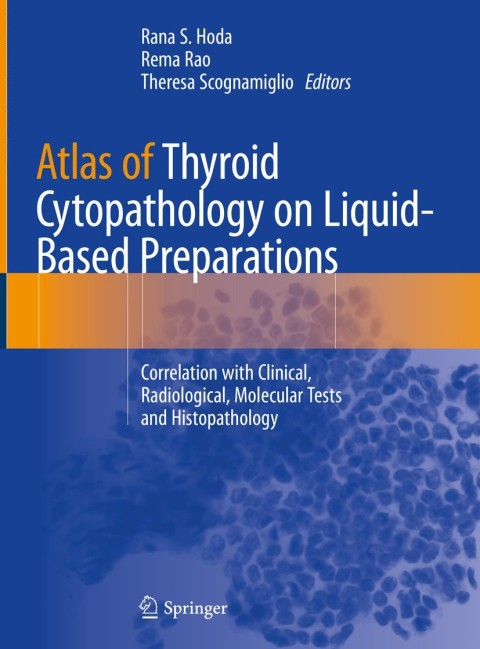 Cover image for book Atlas of Thyroid Cytopathology on Liquid-Based Preparations