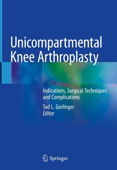 Cover image for book Unicompartmental Knee Arthroplasty