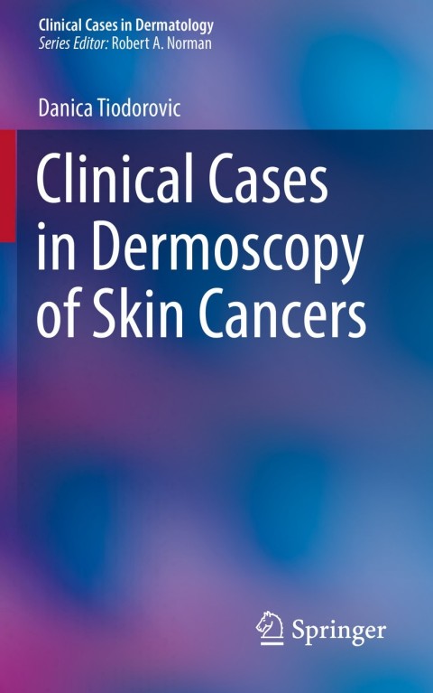 Cover image for book Clinical Cases in Dermoscopy of Skin Cancers