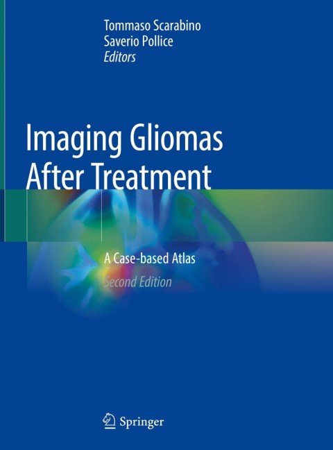 Cover image for book Imaging Gliomas After Treatment