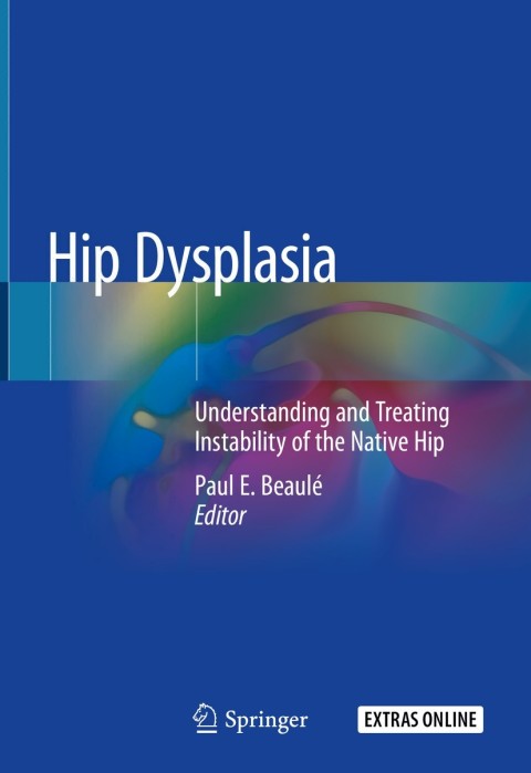 Cover image for book Hip Dysplasia