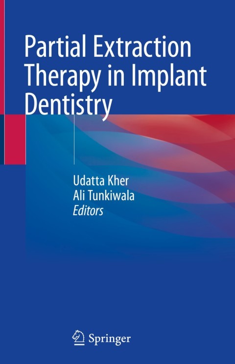 Cover image for book Partial Extraction Therapy in Implant Dentistry