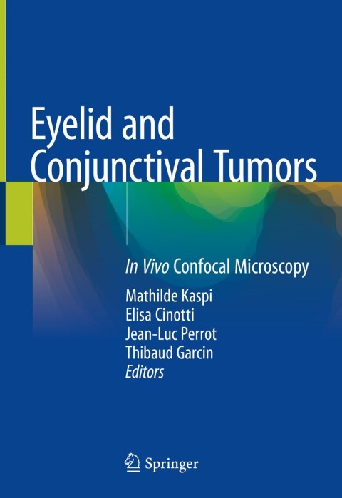 Cover image for book Eyelid and Conjunctival Tumors