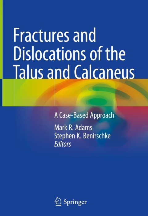 Cover image for book Fractures and Dislocations of the Talus and Calcaneus