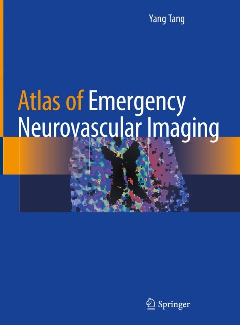 Cover image for book Atlas of Emergency Neurovascular Imaging