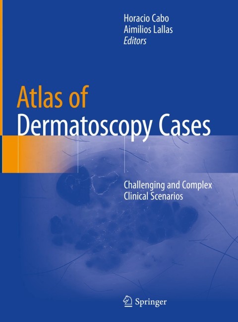 Cover image for book Atlas of Dermatoscopy Cases