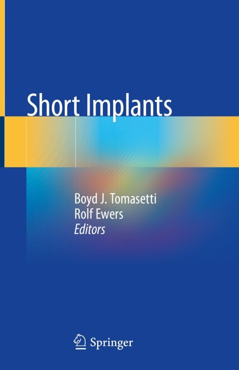 Cover image for book Short Implants