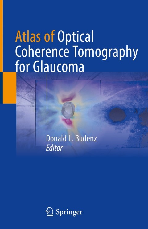 Cover image for book Atlas of Optical Coherence Tomography for Glaucoma