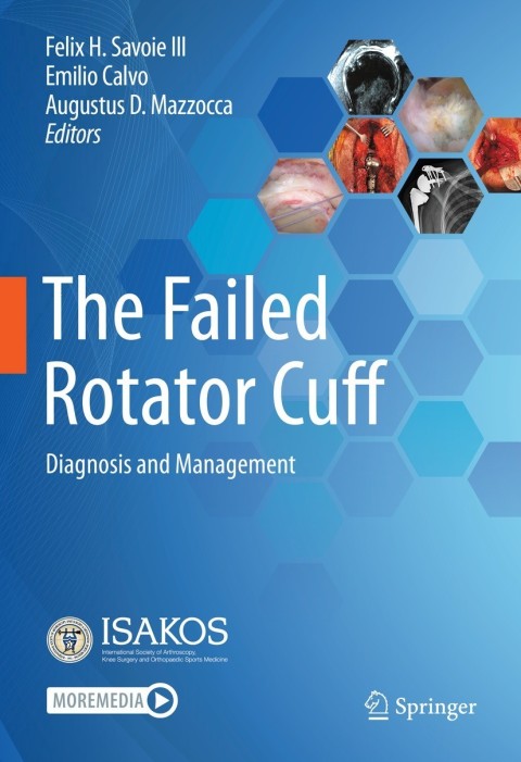 Cover image for book The Failed Rotator Cuff