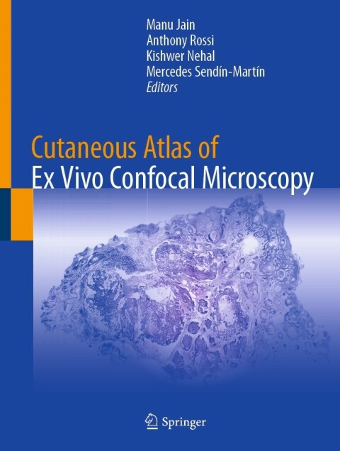 Cover image for book Cutaneous Atlas of Ex Vivo Confocal Microscopy