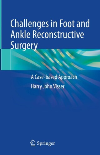 Challenges in Foot and Ankle Reconstructive Surgery