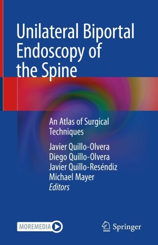 Unilateral Biportal Endoscopy of the Spine