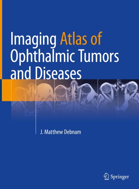 Cover image for book Imaging Atlas of Ophthalmic Tumors and Diseases