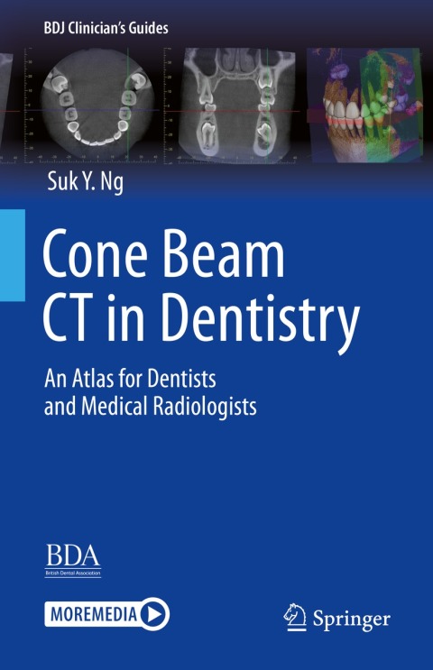 Cover image for book Cone Beam CT in Dentistry