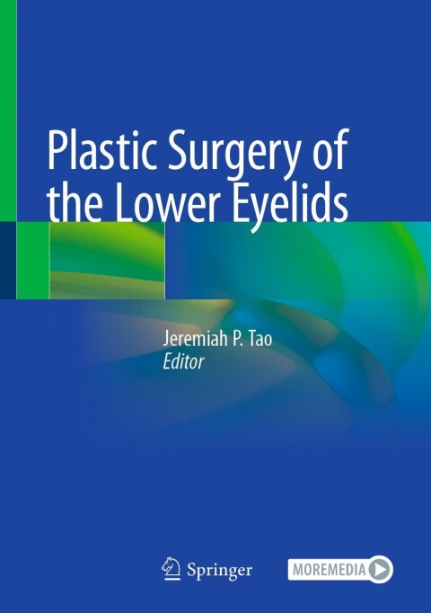 Cover image for book Plastic Surgery of the Lower Eyelids