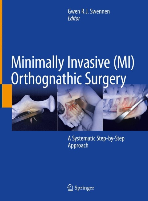 Cover image for book Minimally Invasive (MI) Orthognathic Surgery