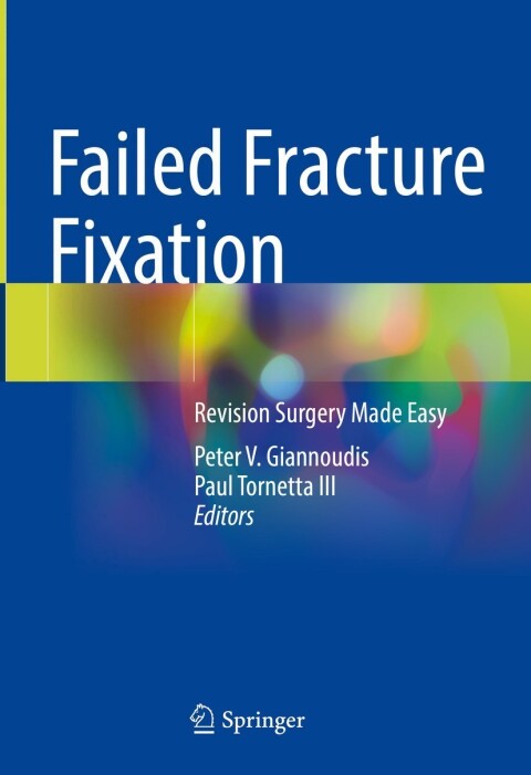 Failed Fracture Fixation 