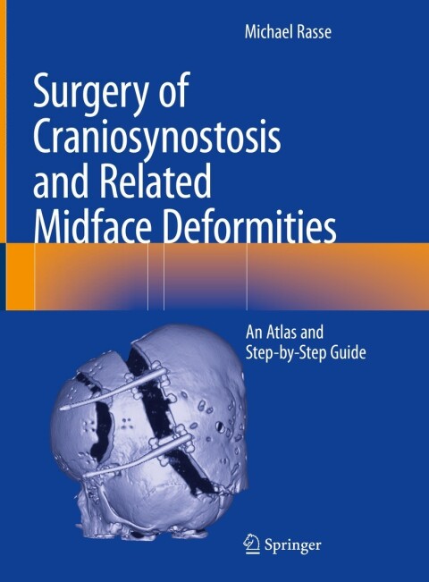 Cover image for book Surgery of Craniosynostosis and Related Midface Deformities