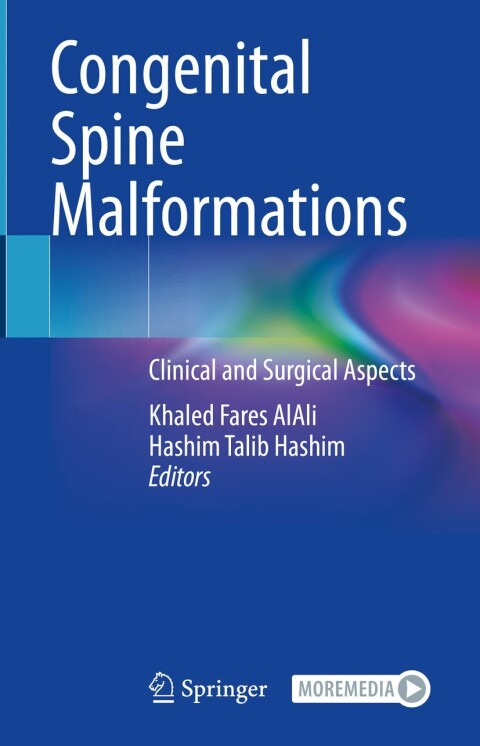 Cover image for book Congenital Spine Malformations