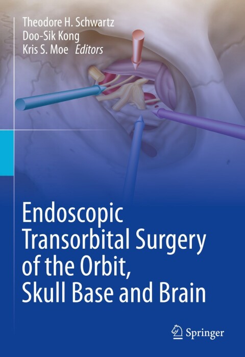 Cover image for book Endoscopic Transorbital Surgery of the Orbit, Skull Base and Brain