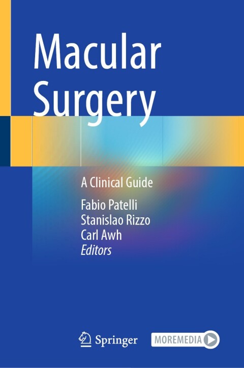Cover image for book Macular Surgery