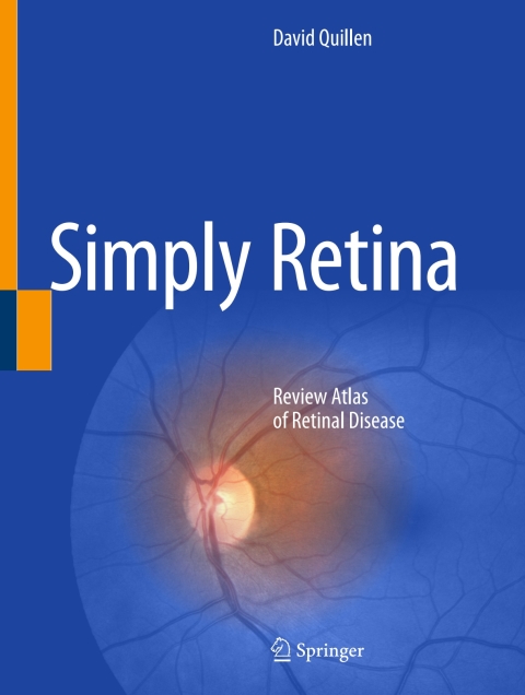 Cover image for book Simply Retina