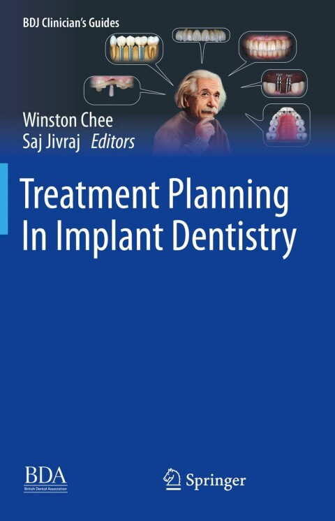 Cover image for book Treatment Planning In Implant Dentistry