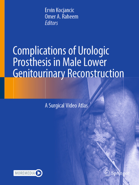 Cover image for book Complications of Urologic Prosthesis in Male Lower Genitourinary Reconstruction