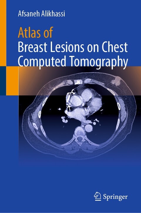 Cover image for book Atlas of Breast Lesions on Chest Computed Tomography