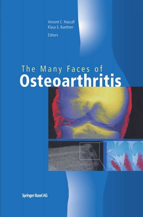 Cover image for book The Many Faces of Osteoarthritis