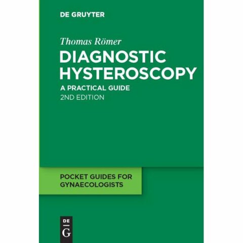 Cover image for book Diagnostic Hysteroscopy