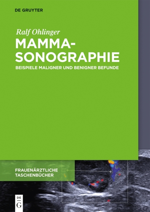 Cover image for book Mammasonographie