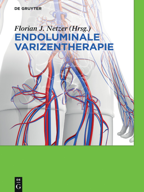 Cover image for book Endoluminale Varizentherapie