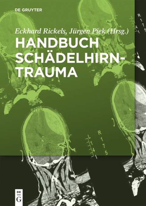Cover image for book Handbuch Schädelhirntrauma