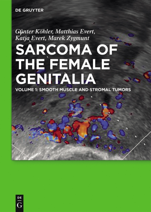 Cover image for book Smooth muscle and stromal tumors and prevention of inadequate surgery