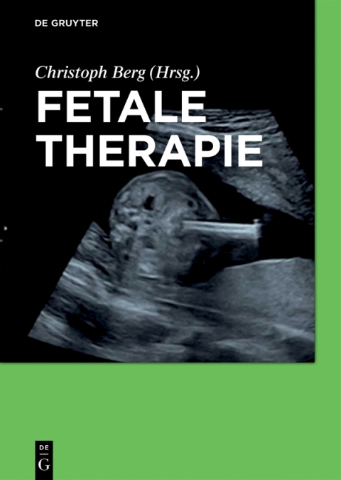 Cover image for book Fetale Therapie