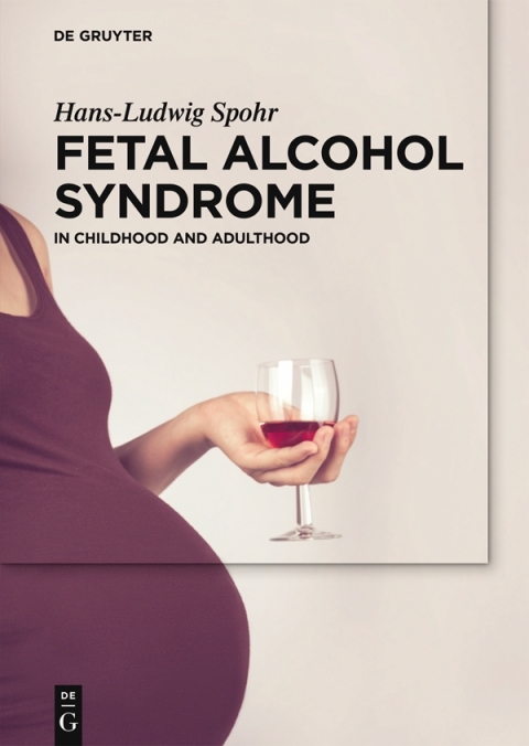 Cover image for book Fetal Alcohol Syndrome