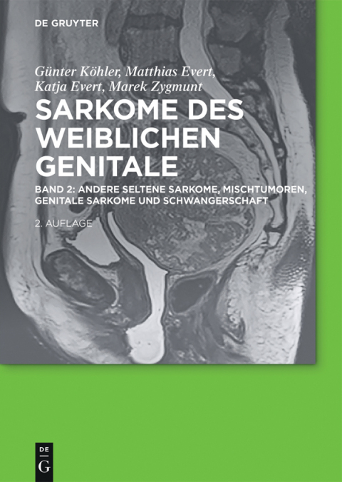 Cover image for book Andere seltene Sarkome, Mischtumoren, genitale Sarkome und Schwangerschaft